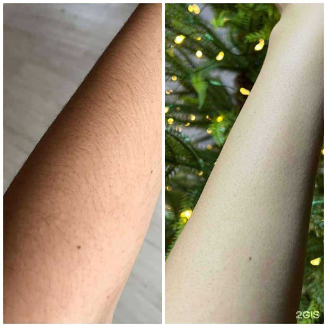 Отзывы на компанию Epil mix в г. Якутск c фото