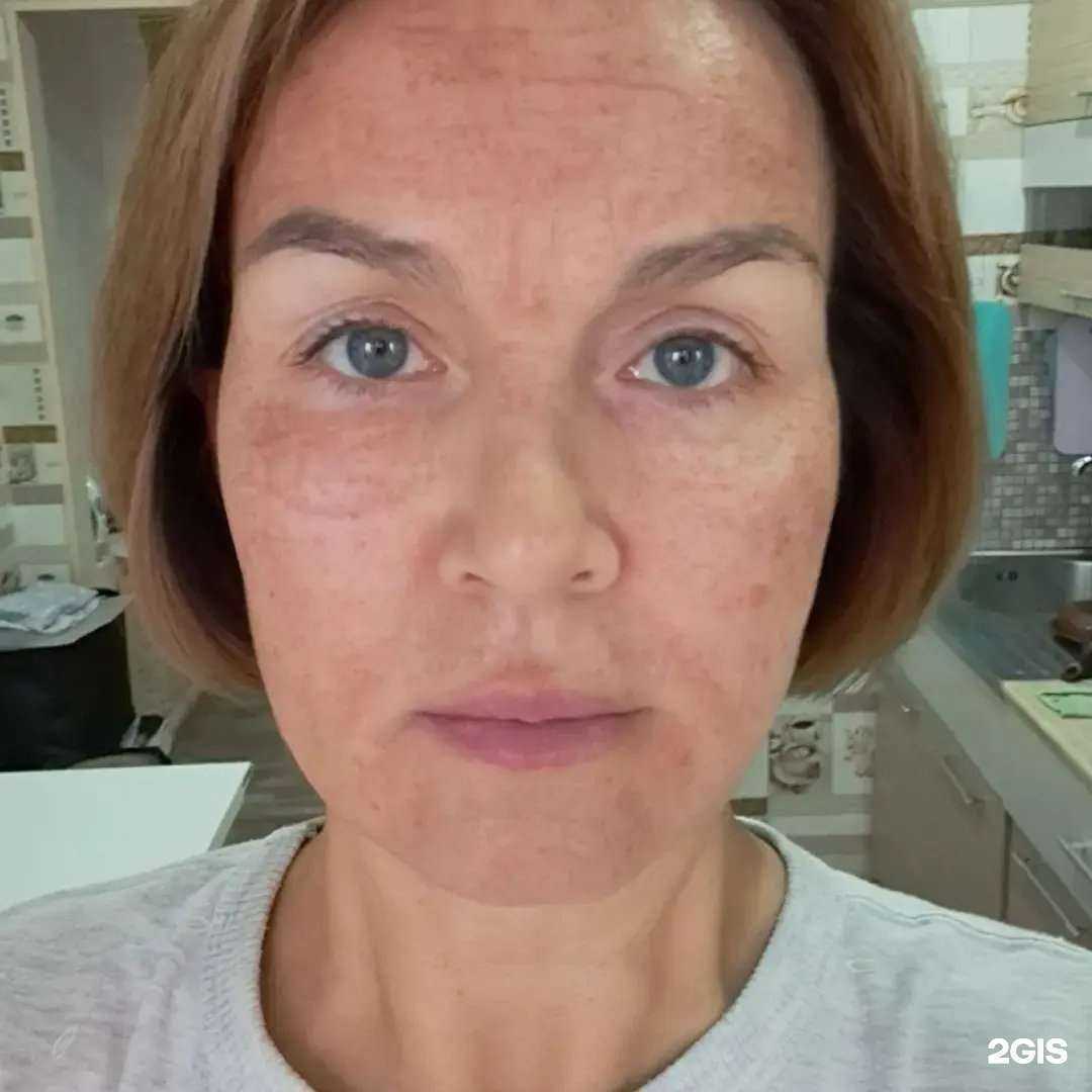 Отзывы на компанию Центр холодной плазмы в Иркутске c фото