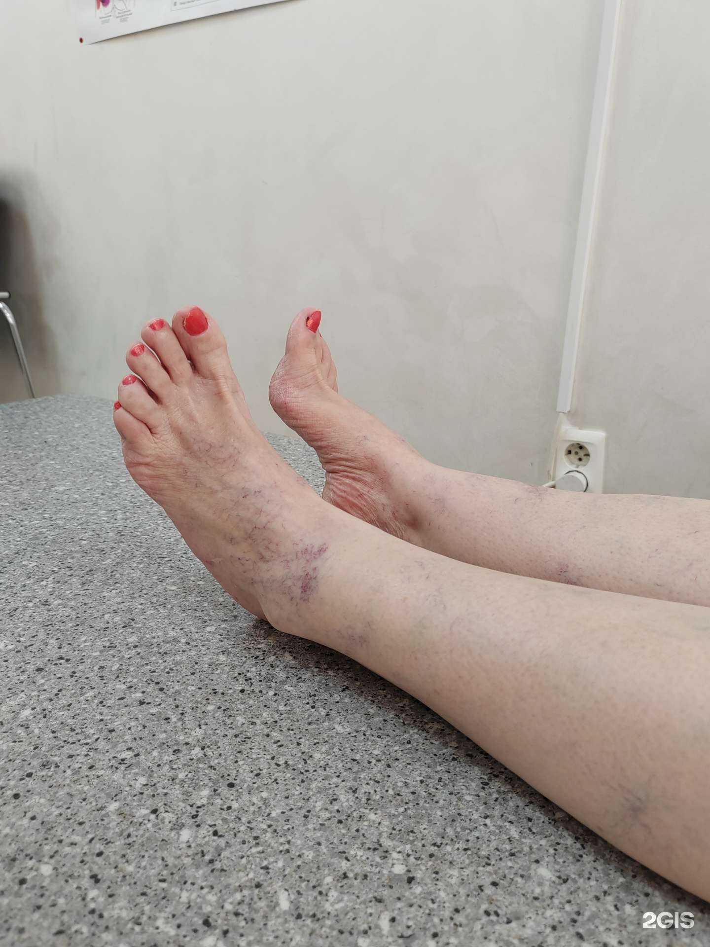 Отзывы на компанию Волна здоровья Миофлекс в г. Ставрополь c фото