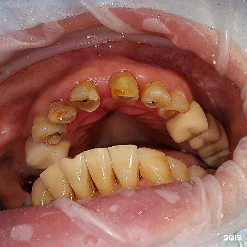 Отзывы на компанию Дантист-Л в Тольятти c фото