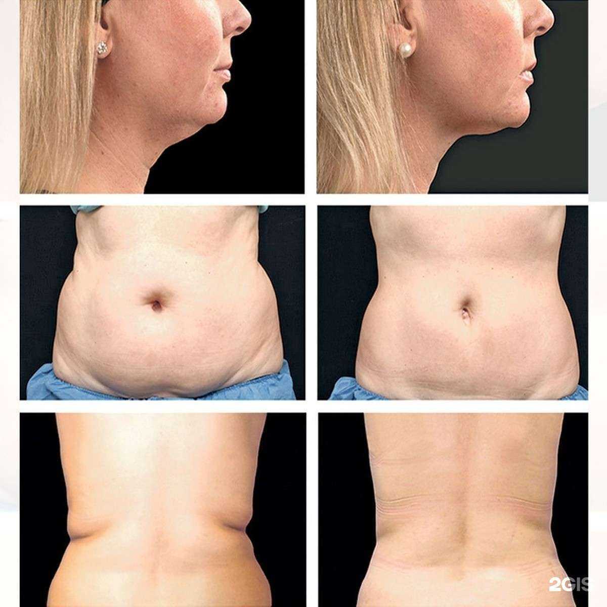 Отзывы на компанию Грация в Тюмени c фото