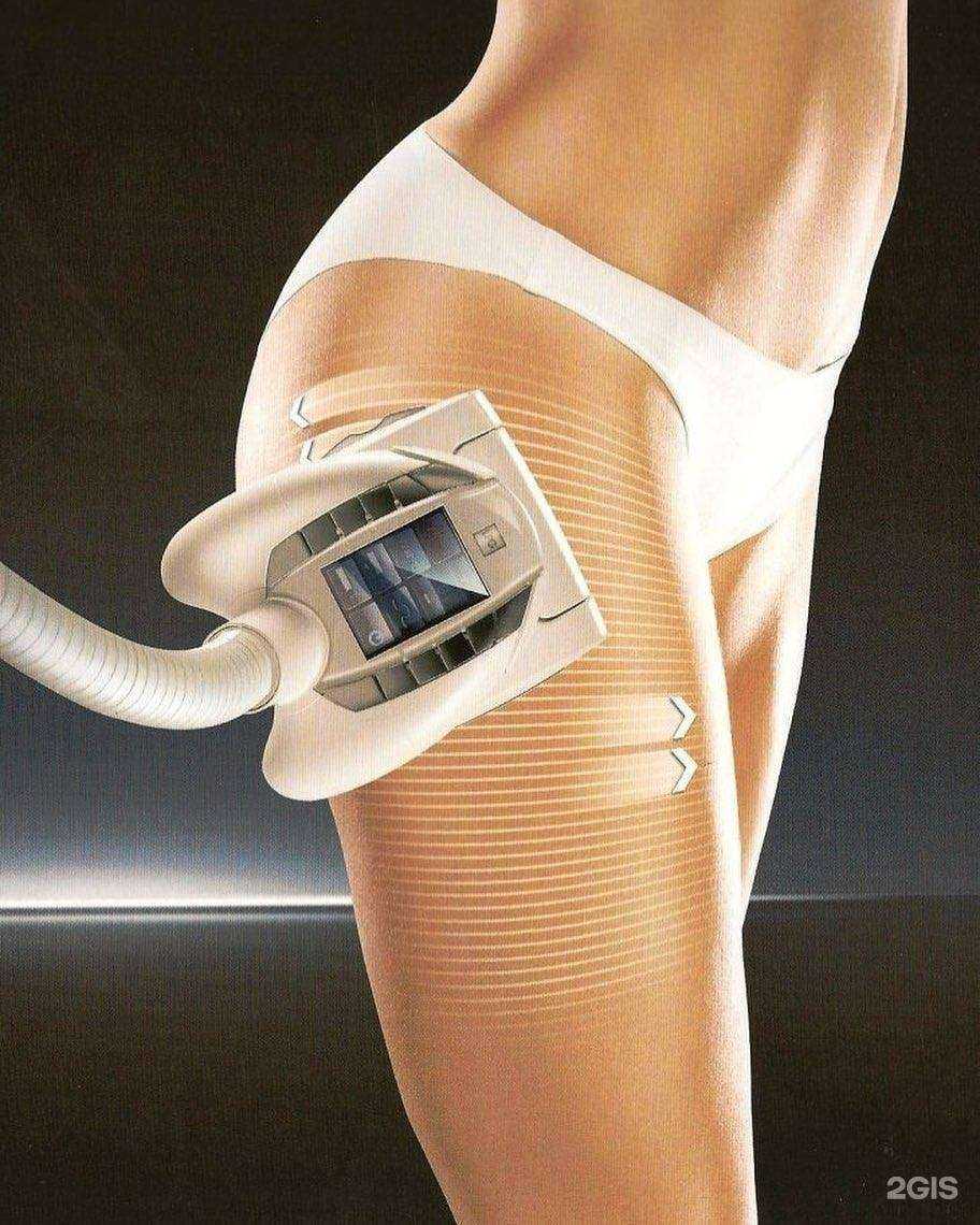 Отзывы на компанию Фокс в г. Полевской c фото