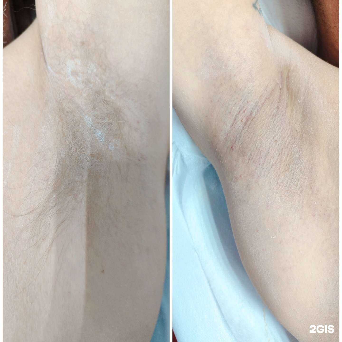 Отзывы на компанию Depilation в Красноярске c фото