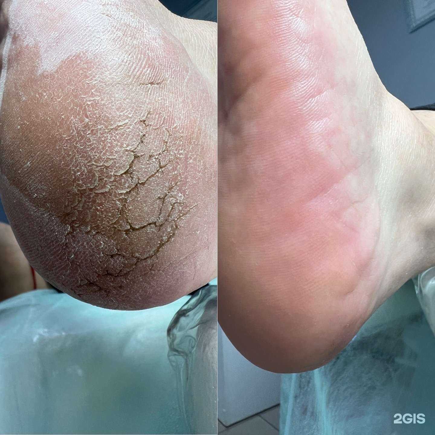 Отзывы на компанию Здоровая эстетика в Улан-Удэ c фото