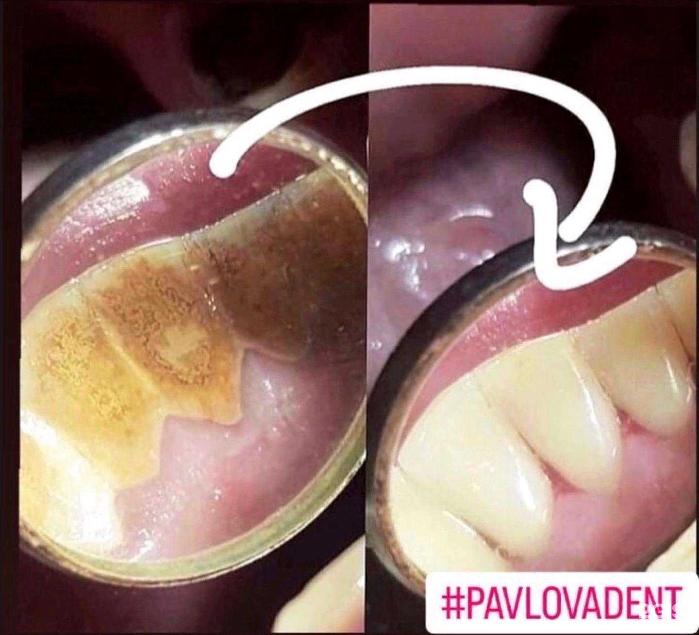 Отзывы на компанию PavlovaDent в Омске c фото