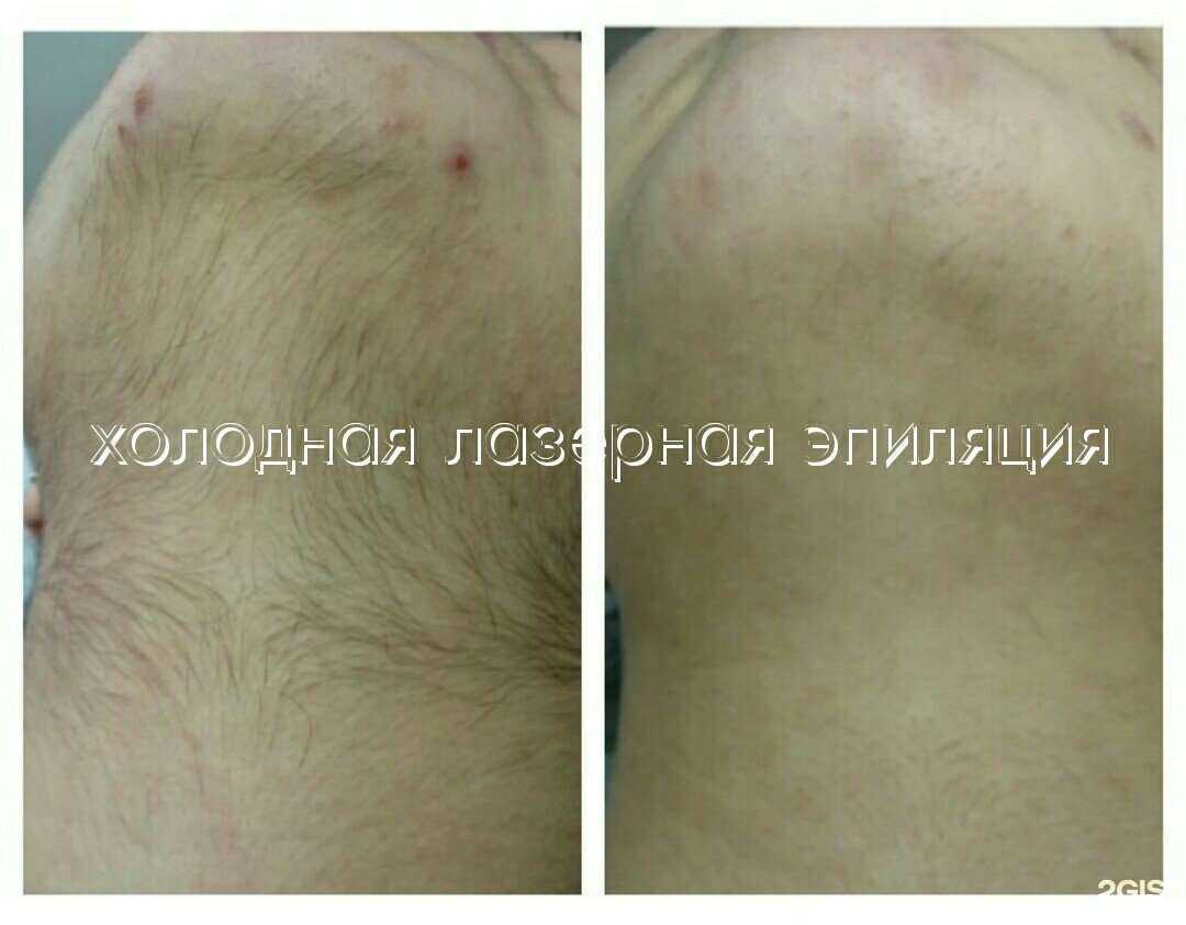 Отзывы на компанию Cool-эпиляция Сочи в Сочи c фото