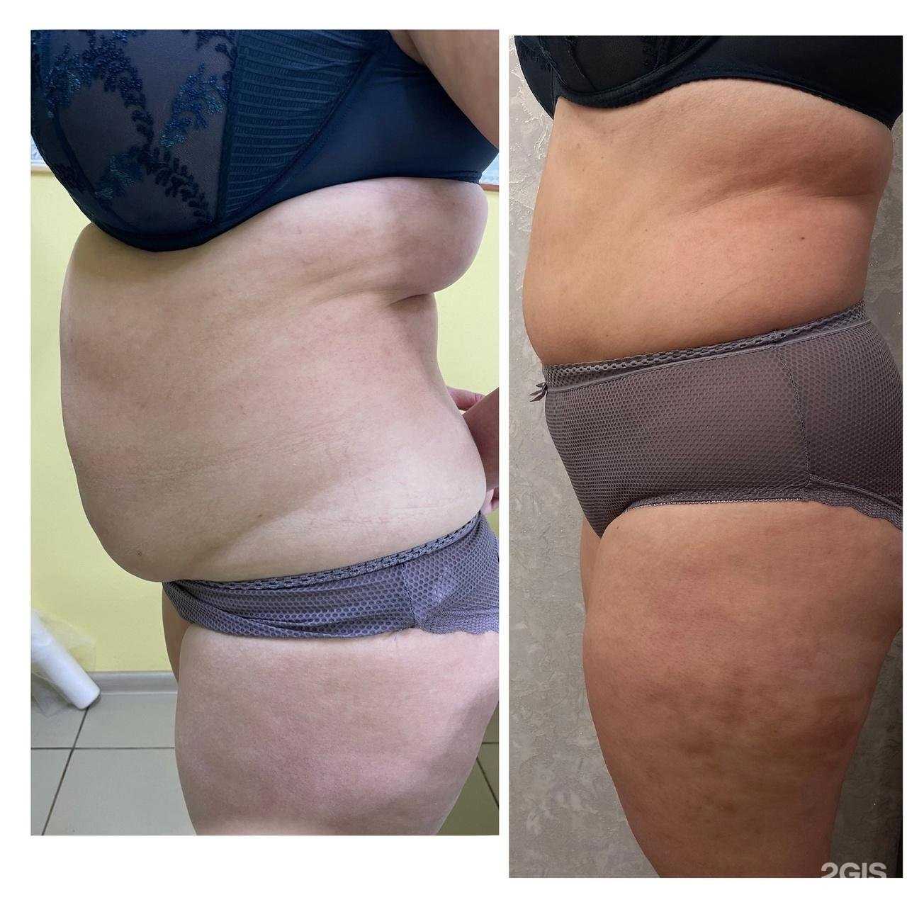 Отзывы на компанию Совершенство в г. Арзамас c фото