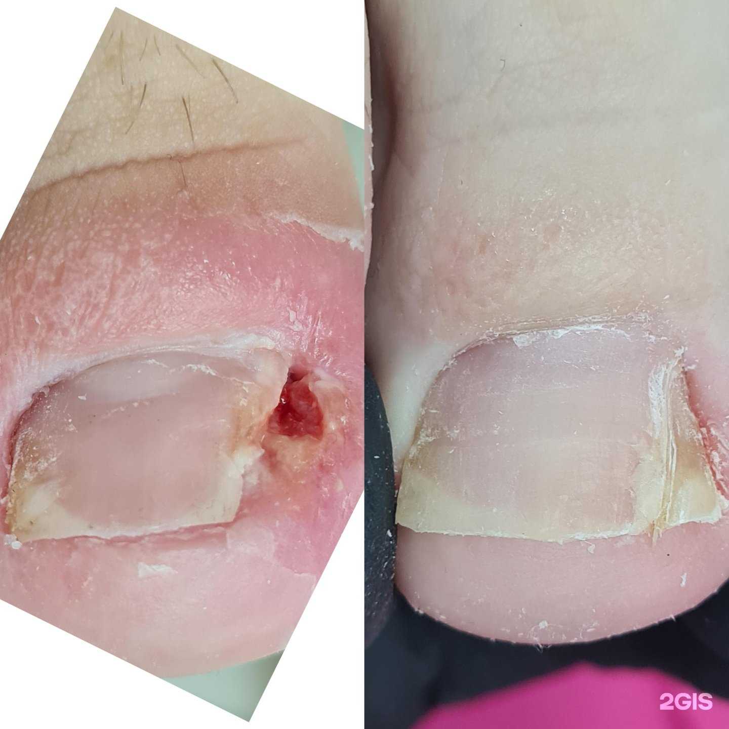 Отзывы на компанию Кабинет подолога Марины Климкиной в Пензе c фото