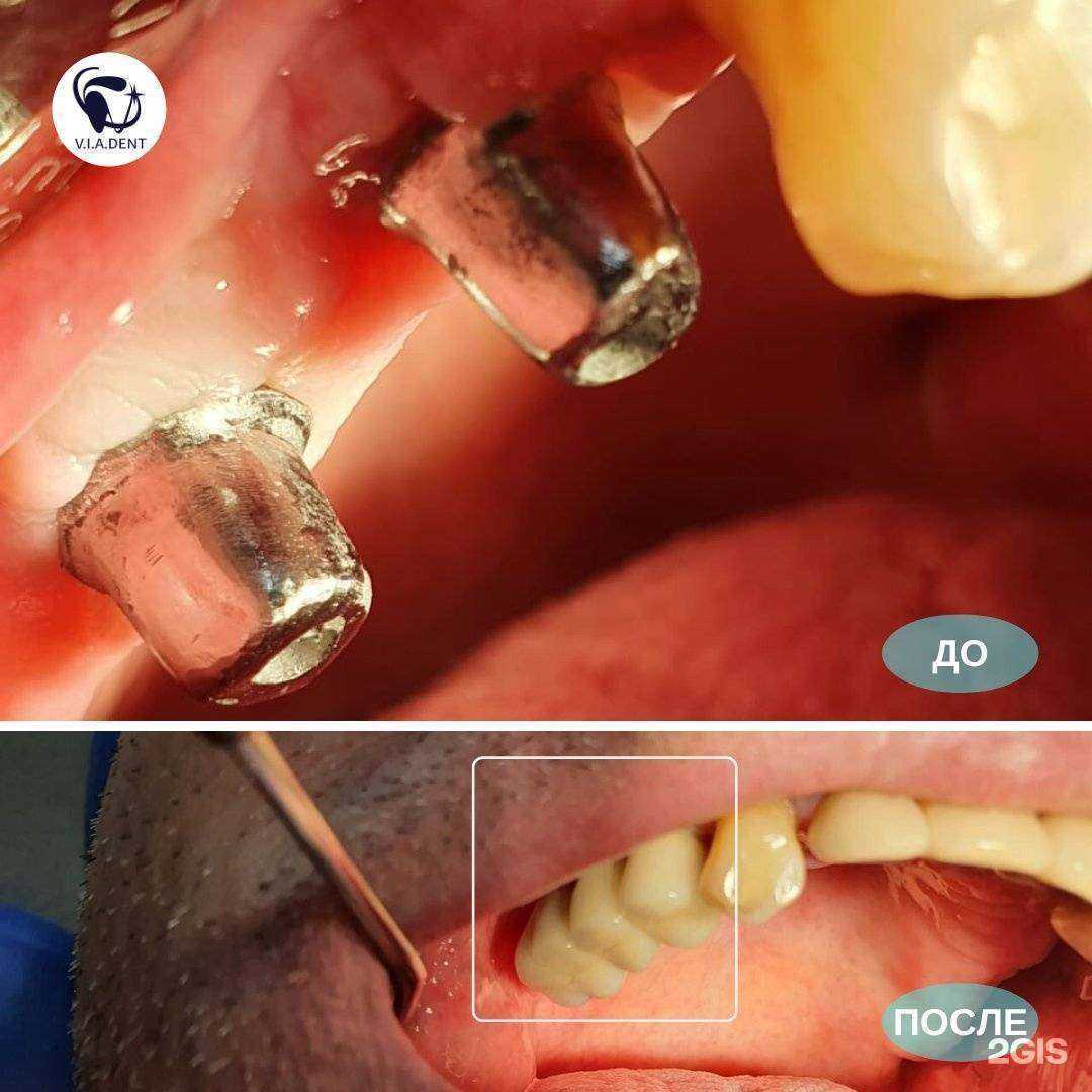 Отзывы на компанию V.i.a. dent в Самаре c фото