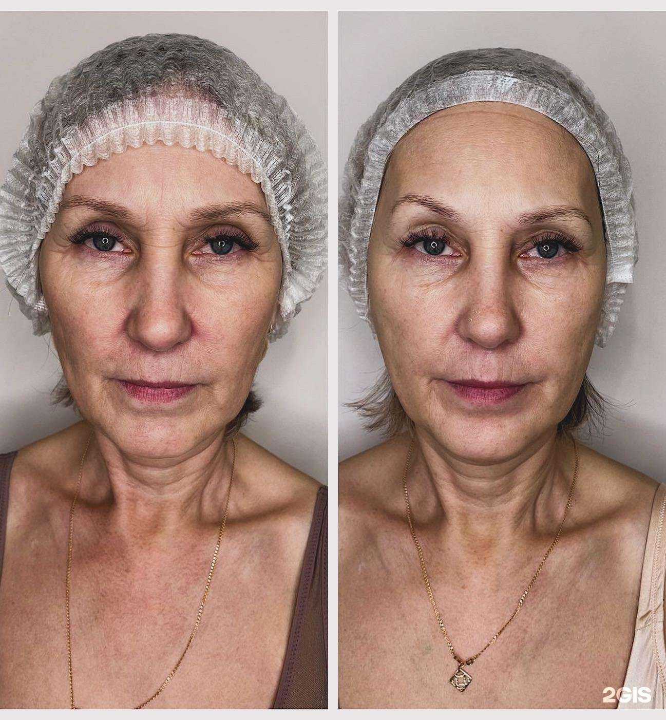 Отзывы на компанию Epil house в г. Осинники c фото