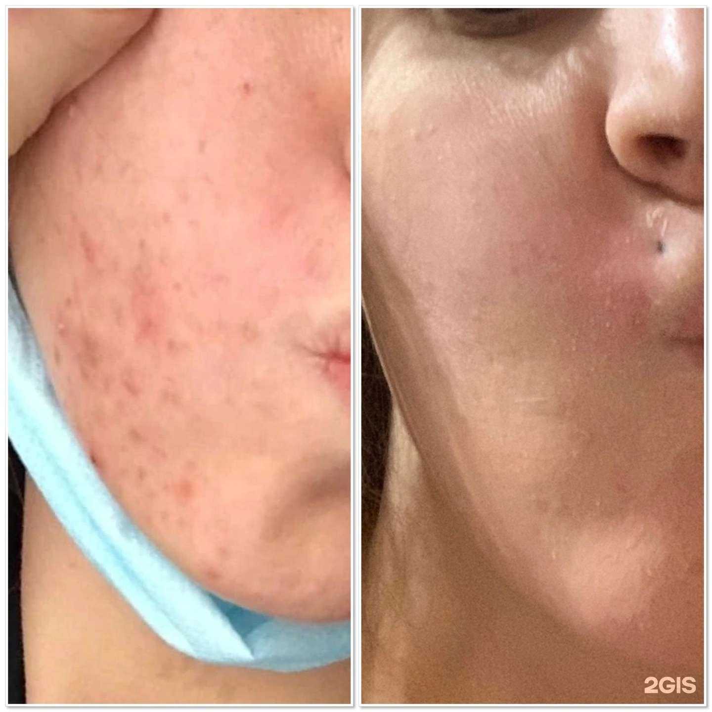 Отзывы на компанию TopFace в г. Нижневартовск c фото