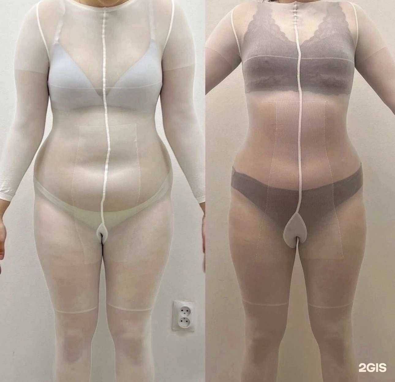 Отзывы на компанию Студия LPG-массажа лазерной эпиляции в Самаре c фото