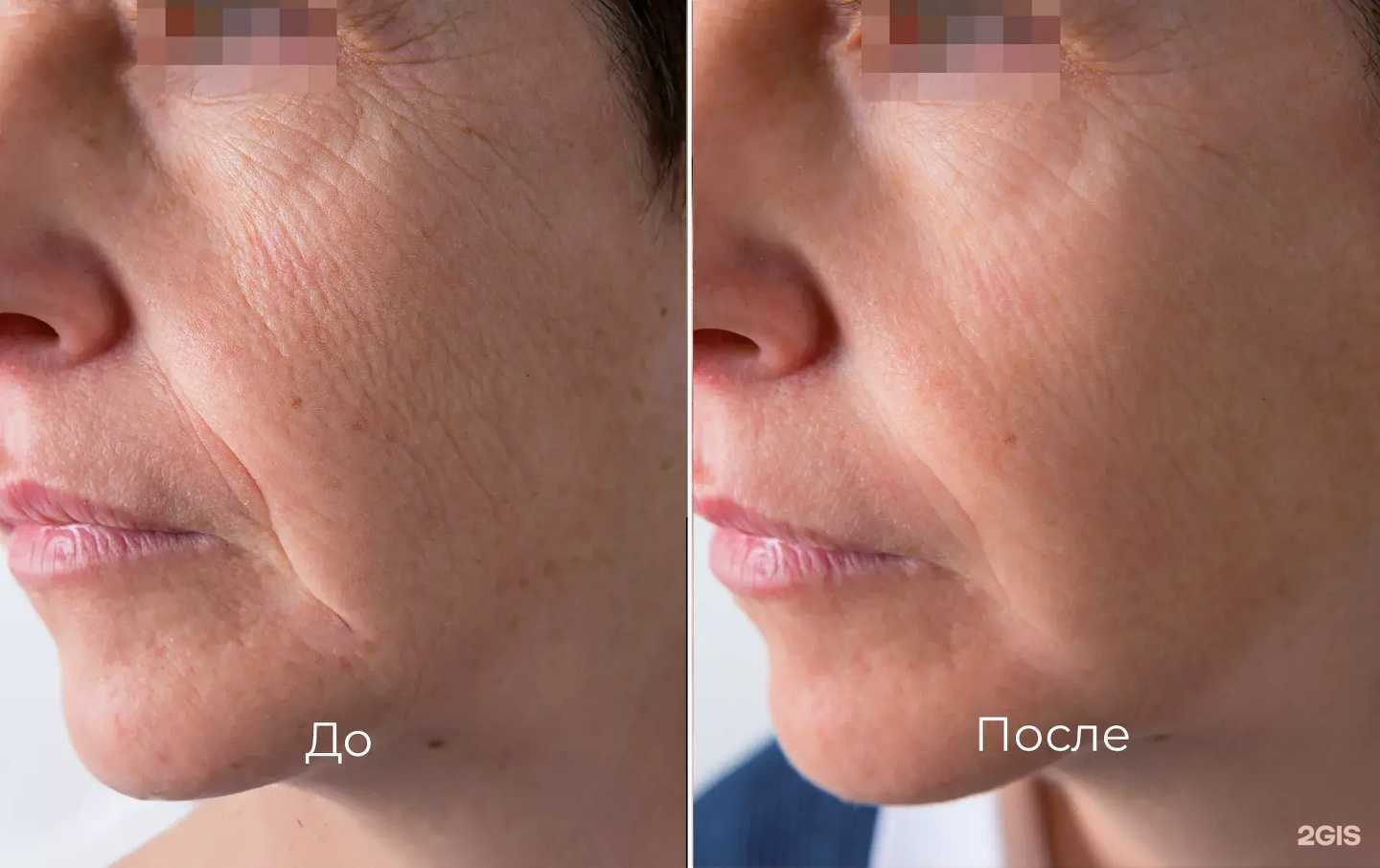 Отзывы на компанию Solo в Иркутске c фото