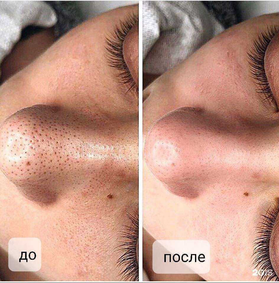 Отзывы на компанию Nega в г. Абакан c фото