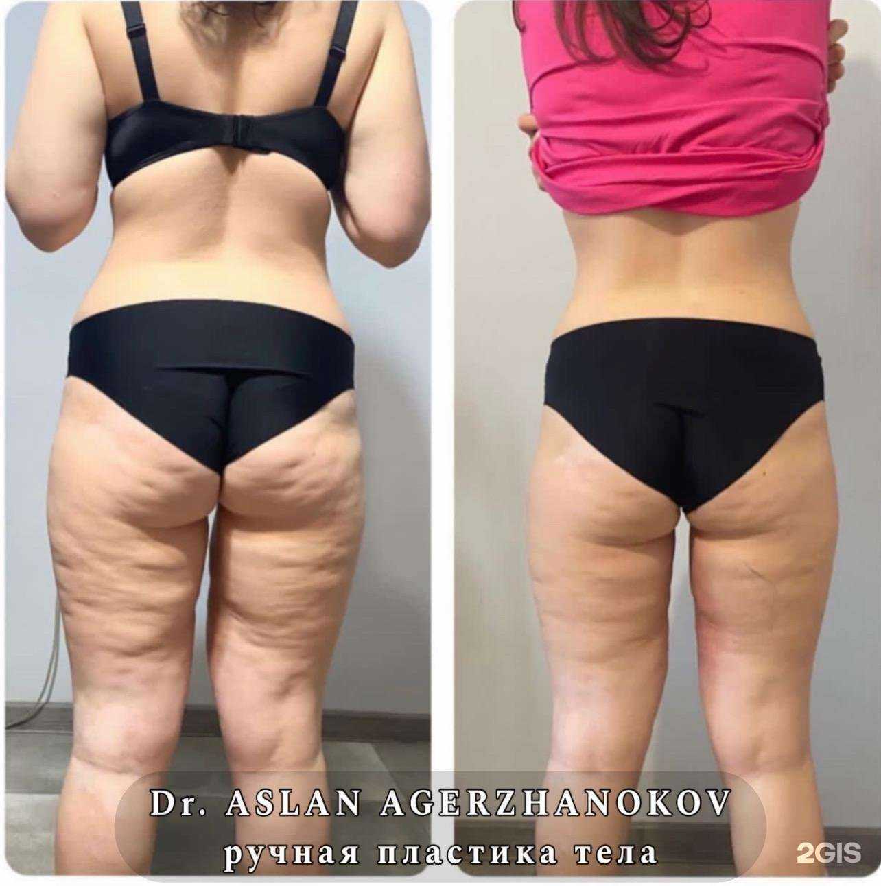 Отзывы на компанию Центр ручной пластики тела в г. Краснодар c фото