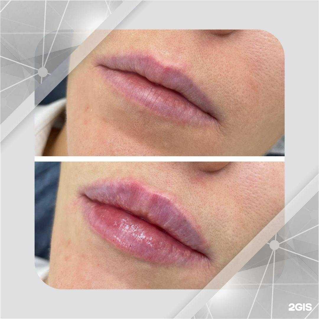 Отзывы на компанию Медэстетик в г. Сызрань c фото