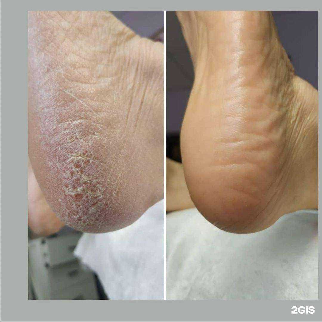 Отзывы на компанию Кабинет подолога в Ноябрьске c фото