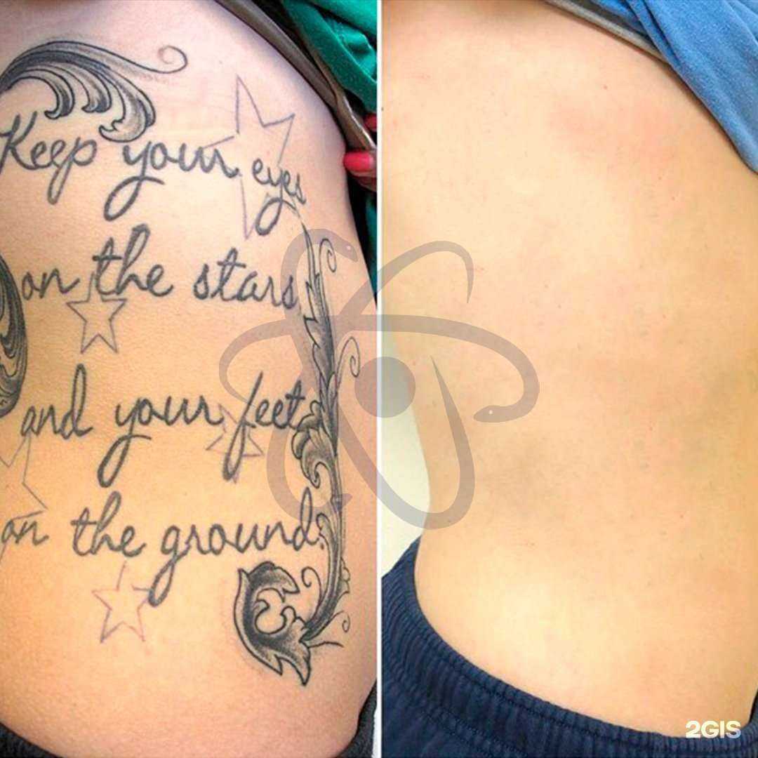 Отзывы на компанию Laser atom в г. Казань c фото