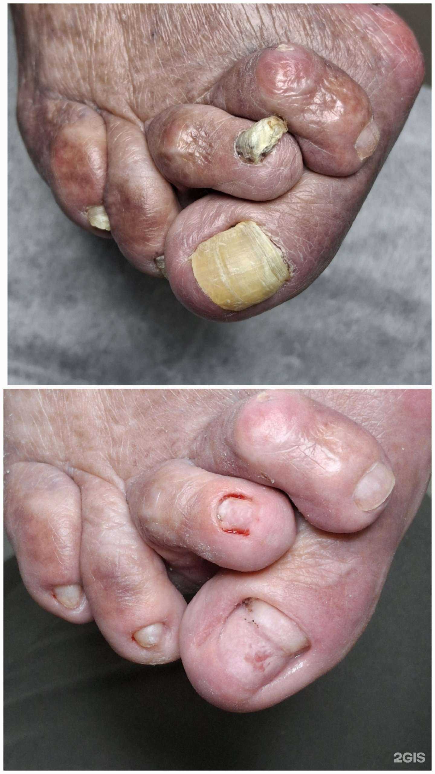 Отзывы на компанию Центр подологии и ногтевого сервиса в Томске c фото