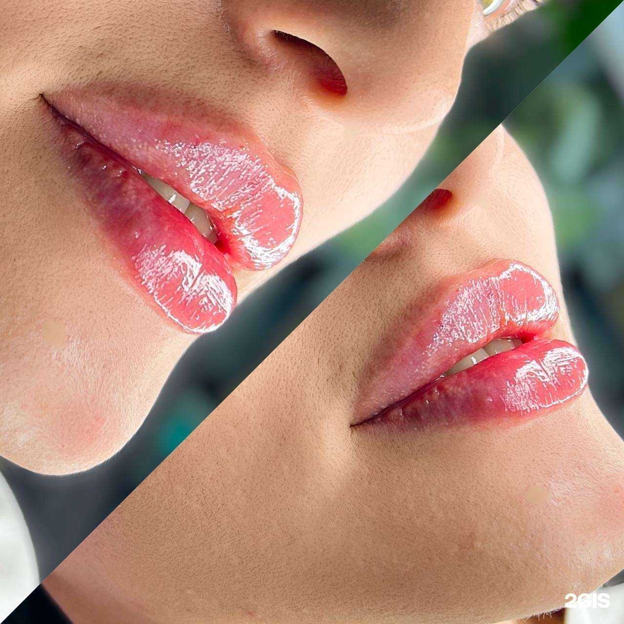 Отзывы на компанию Студия косметологии в Краснодаре c фото