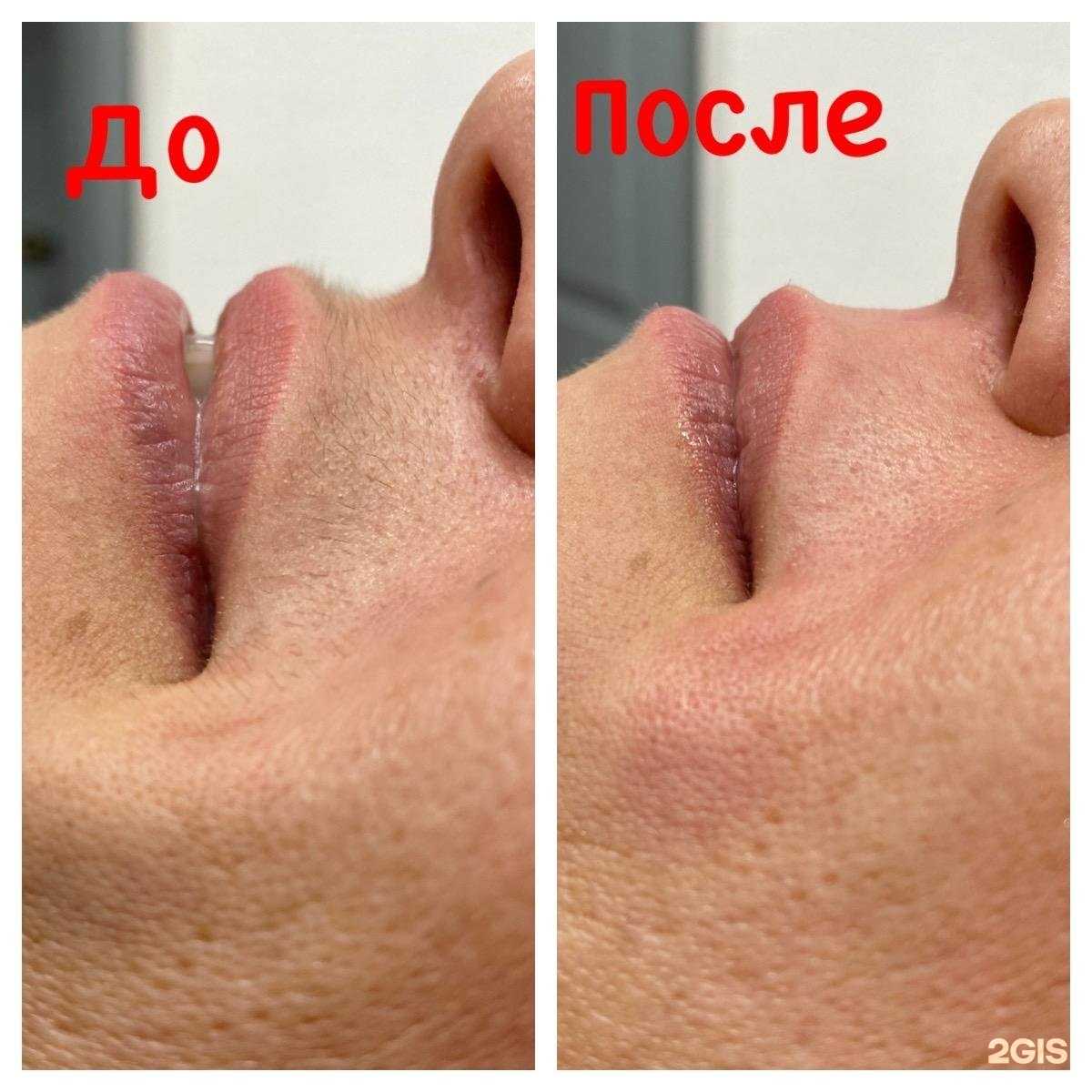 Отзывы на компанию Студия депиляции, коррекции фигуры и массажа в Перми c фото