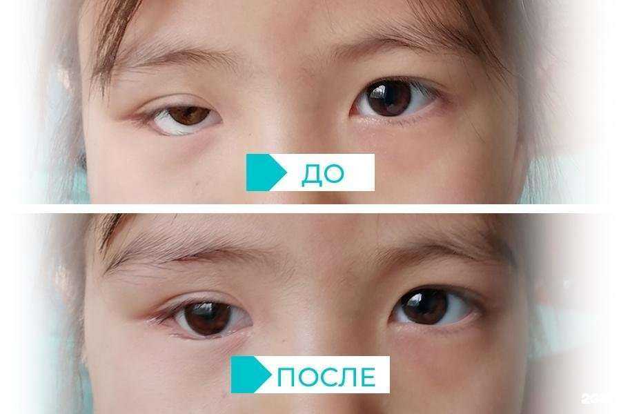 Отзывы на компанию ЦентрГлазОмск в г. Тюмень c фото