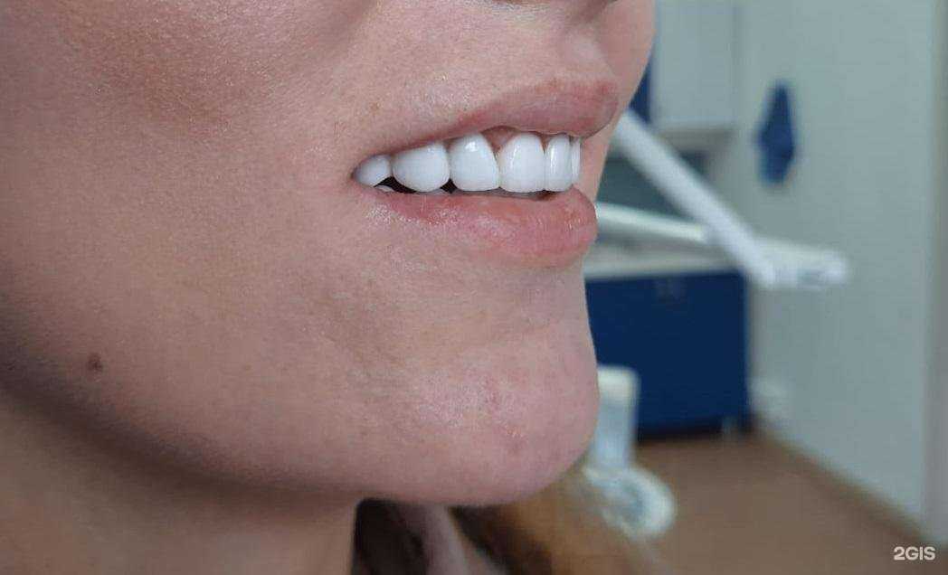 Отзывы на компанию Dent star в г. Новороссийск c фото