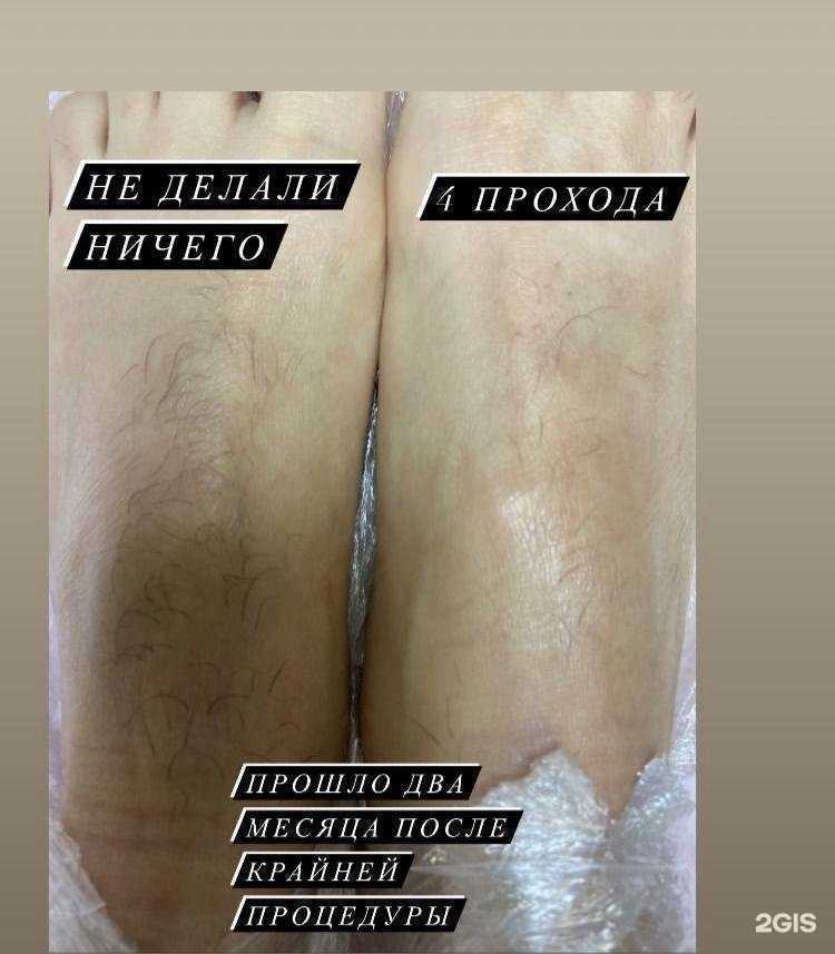 Отзывы на компанию Студия электроэпиляции, восковой депиляции и гелинга в г. Воронеж c фото