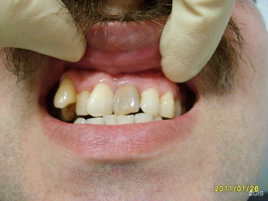 Отзывы на компанию Дента+ в Глазове c фото