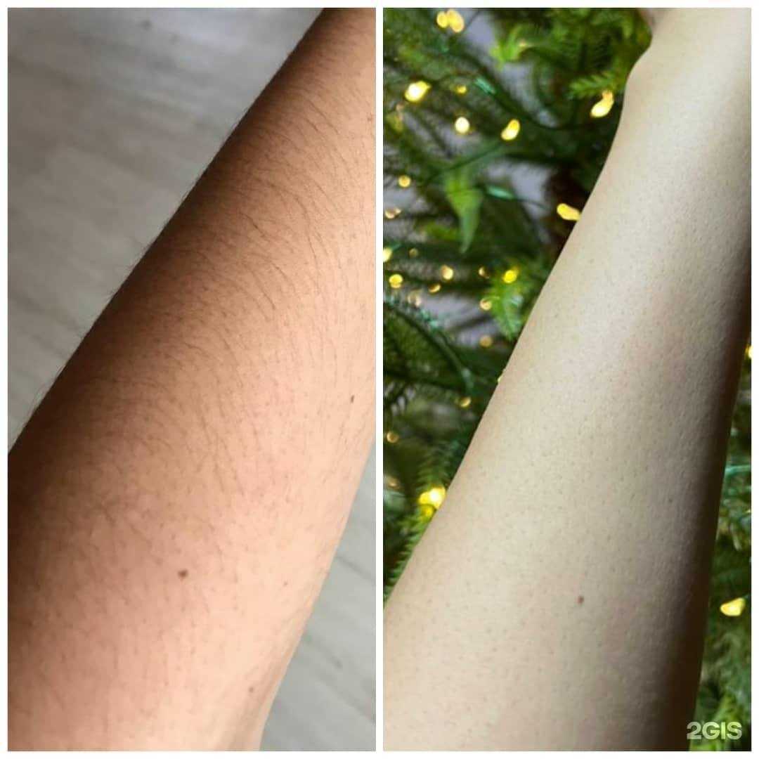 Отзывы на компанию Epil mix в Якутске c фото