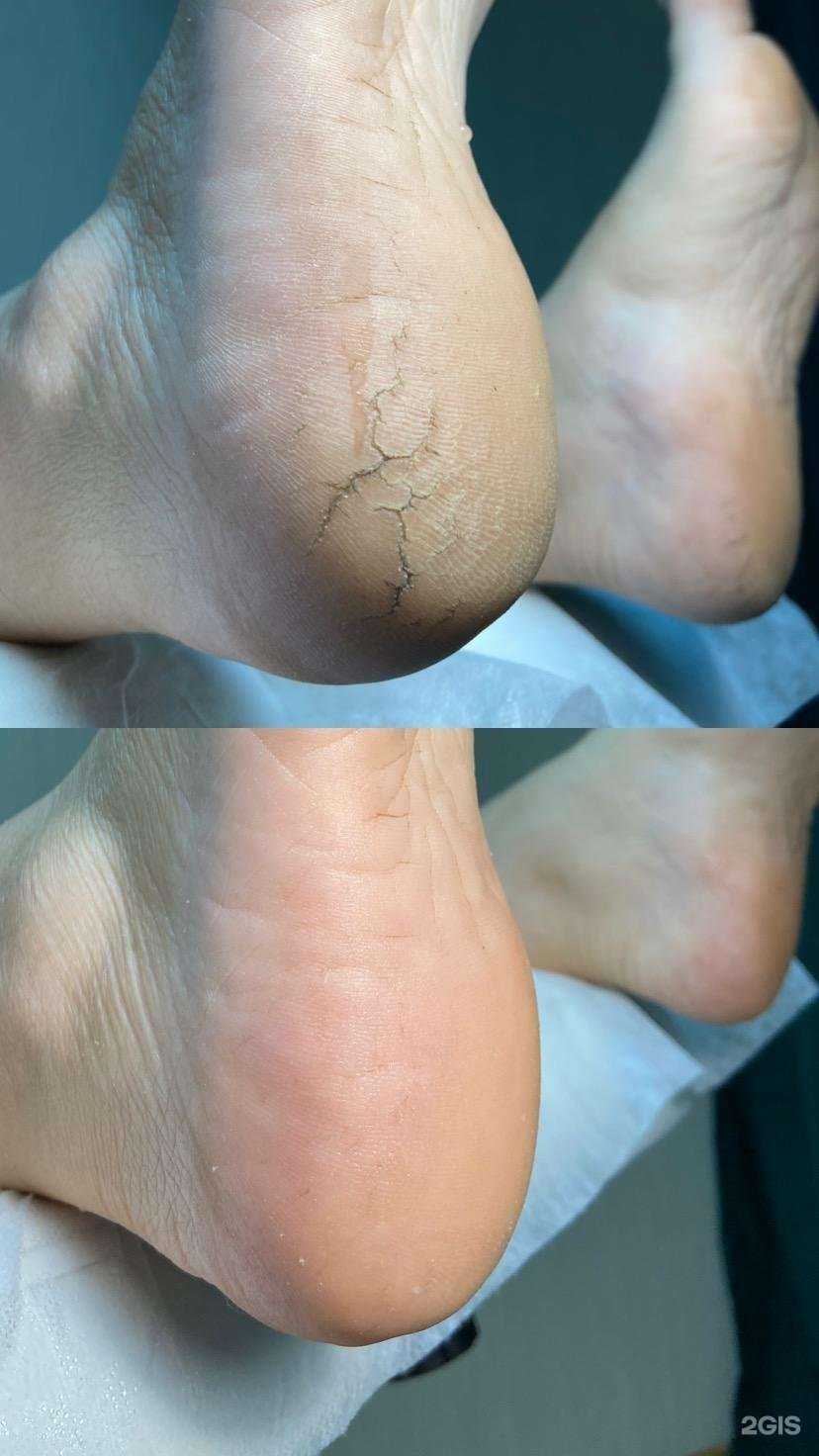 Отзывы на компанию Спинс в Самаре c фото