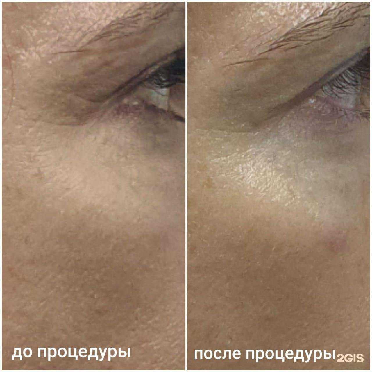 Отзывы на компанию Кабинет эстетической косметологии в Южно-Сахалинске c фото