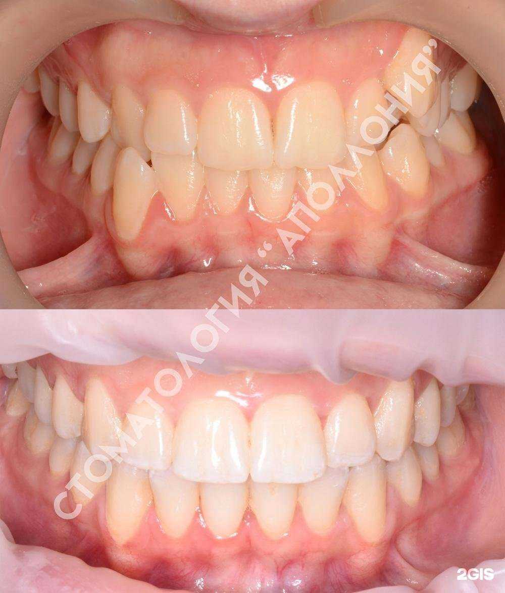 Отзывы на компанию Аполлония в Коврове c фото