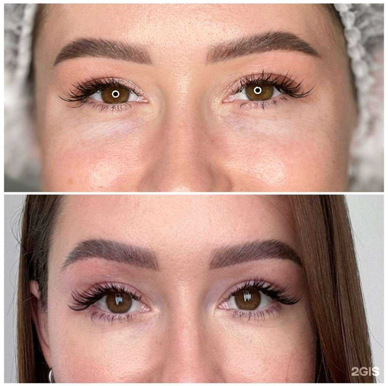 Отзывы на компанию Smas lifting в Краснодаре c фото