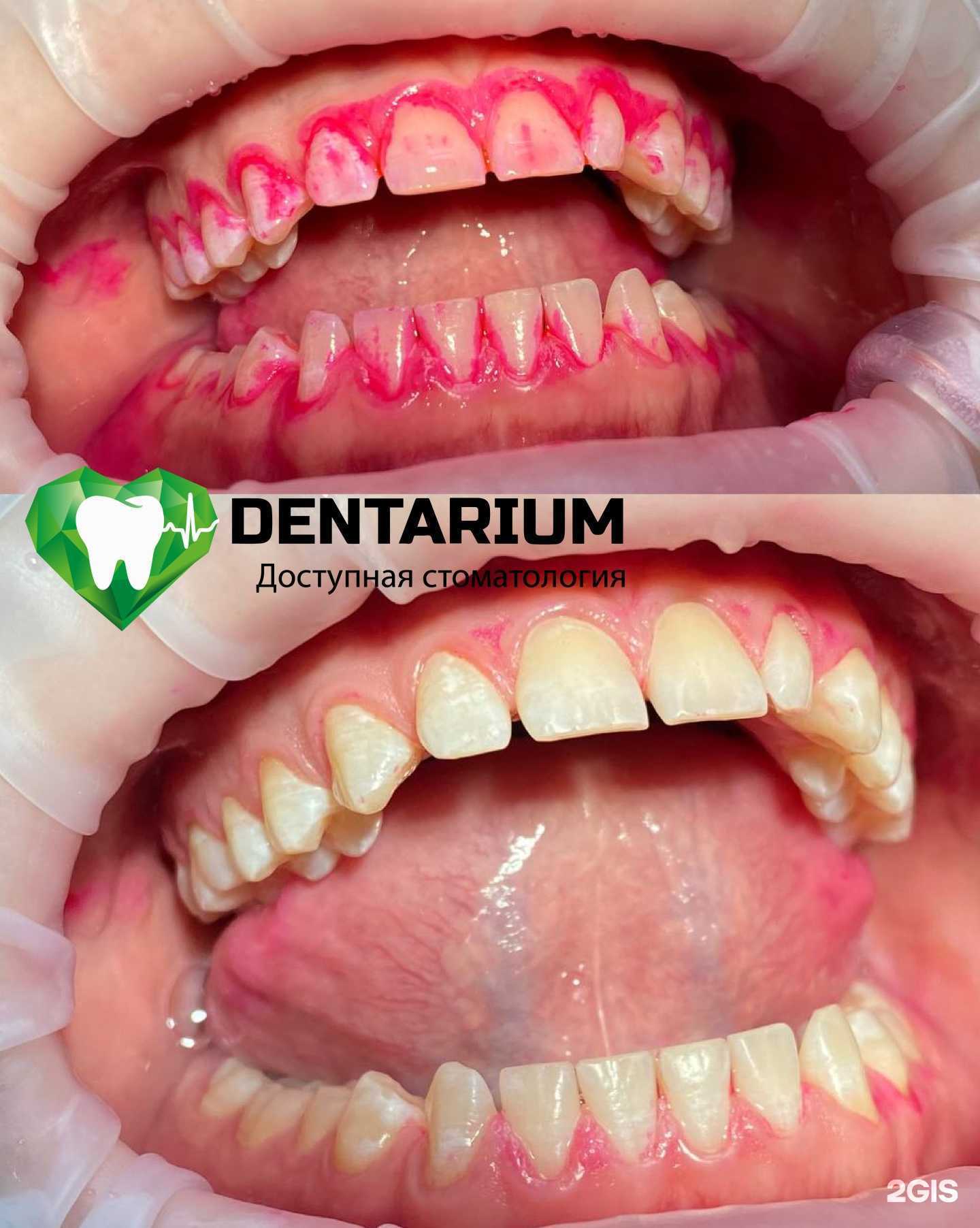 Отзывы на компанию Dentarium в г. Тверь c фото