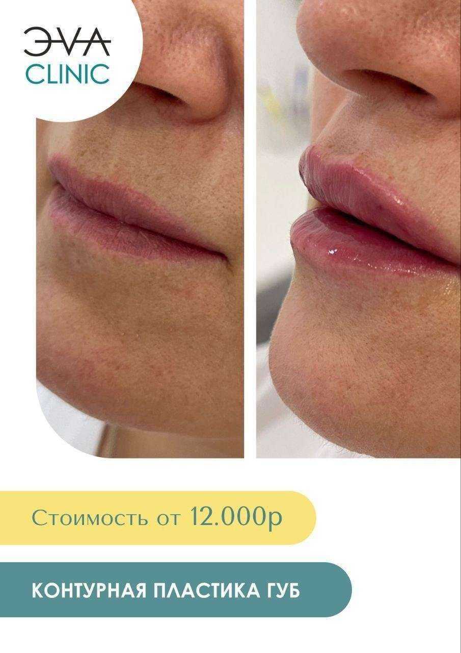 Отзывы на компанию Эva clinic в Калининграде c фото