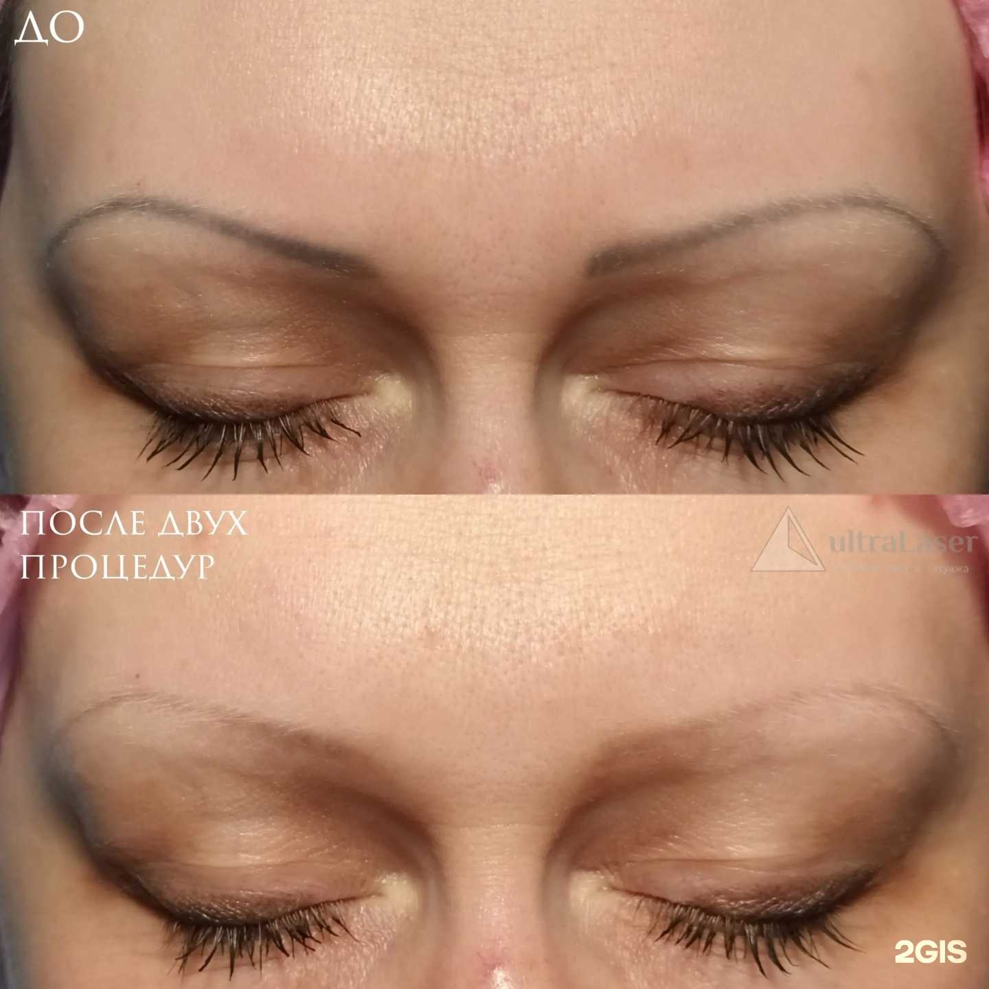 Отзывы на компанию UltraLaser в г. Тольятти c фото