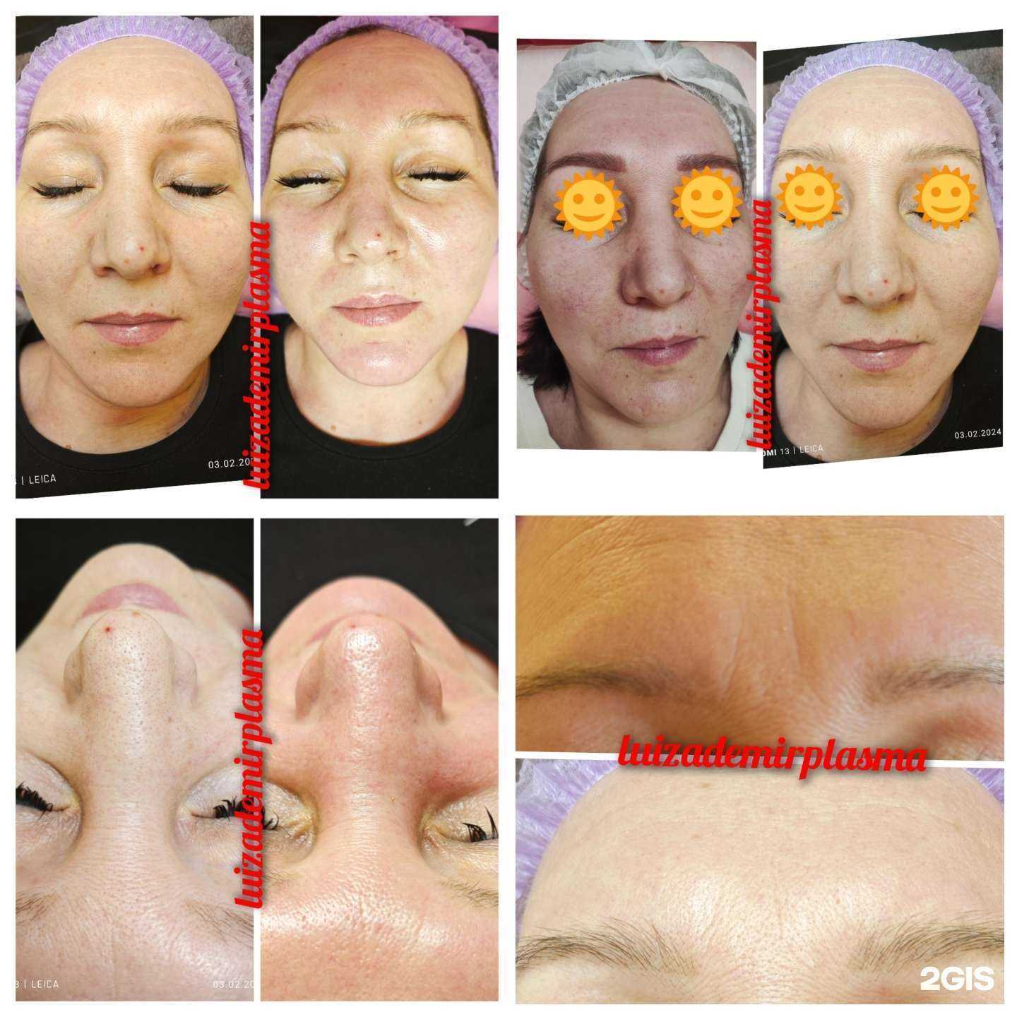 Отзывы на компанию Холодная Плазма в Златоусте c фото