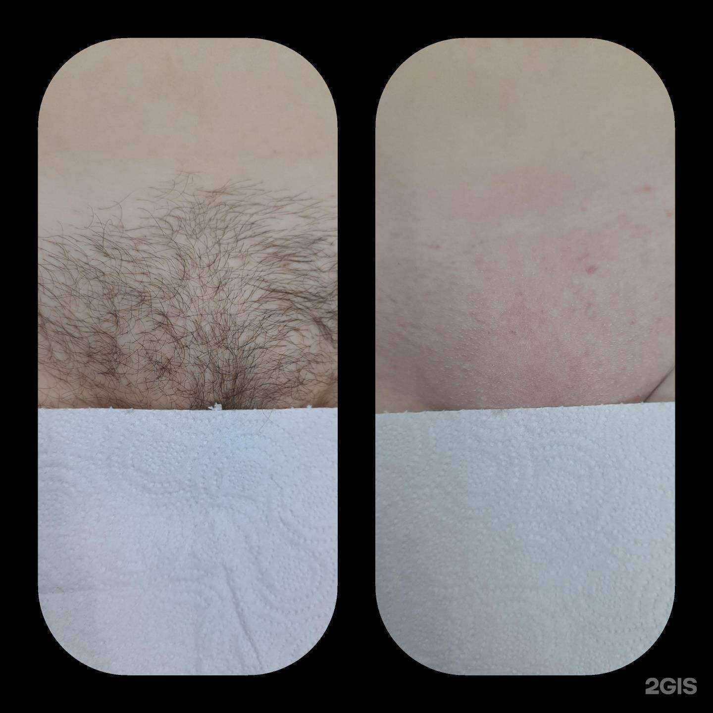 Отзывы на компанию Best Studio в г. Иркутск c фото