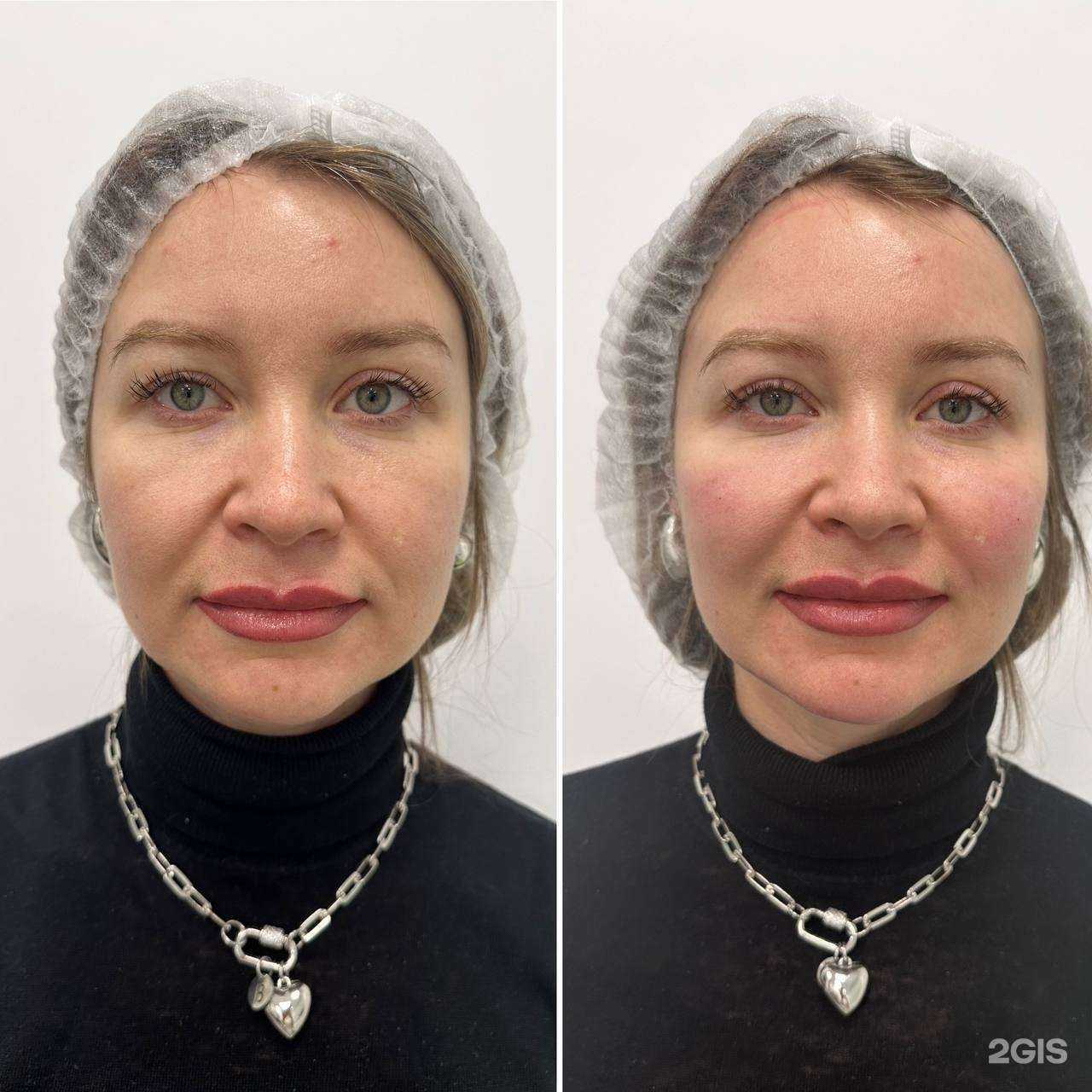 Отзывы на компанию Krasivo сlinic в Казани c фото