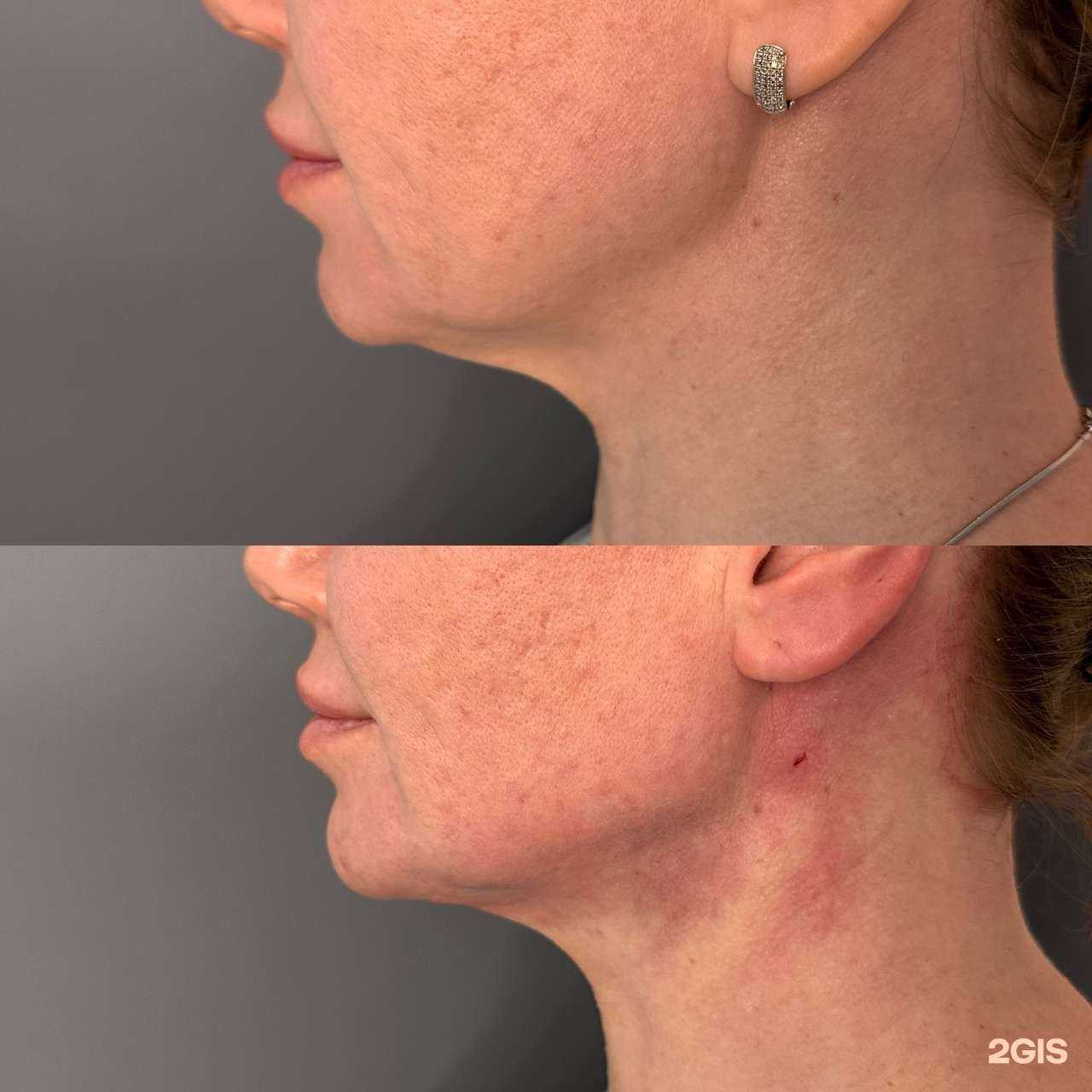 Отзывы на компанию Клиника красоты Алины Крыловой в г. Красноярск c фото