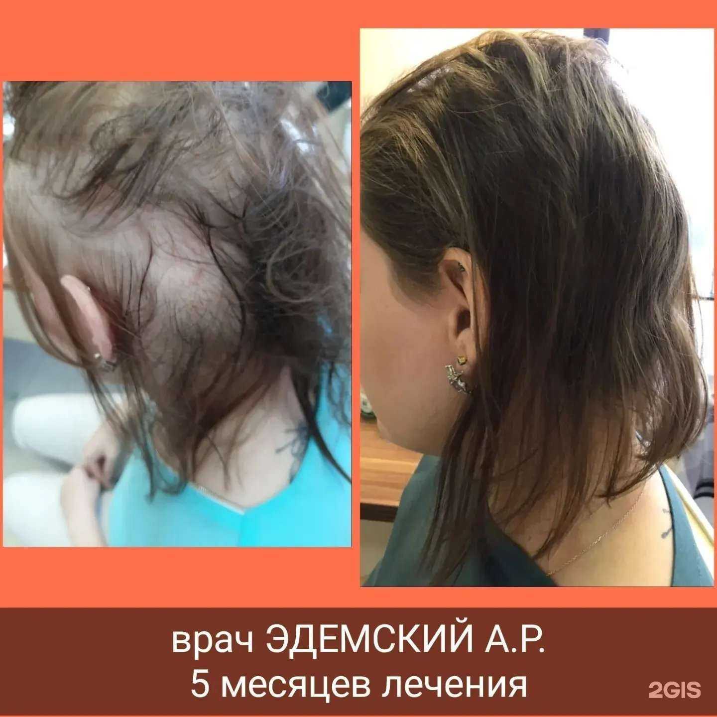 Отзывы на компанию А Лаборатория в Новосибирске c фото