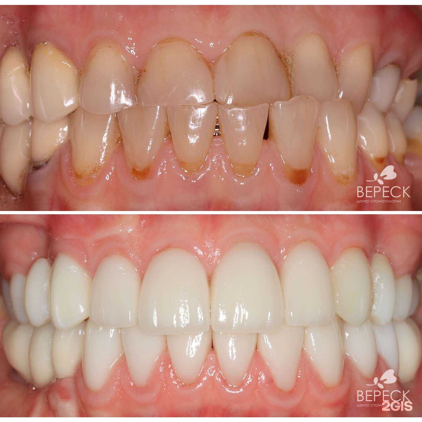 Отзывы на компанию Вереск в Великом Новгороде c фото