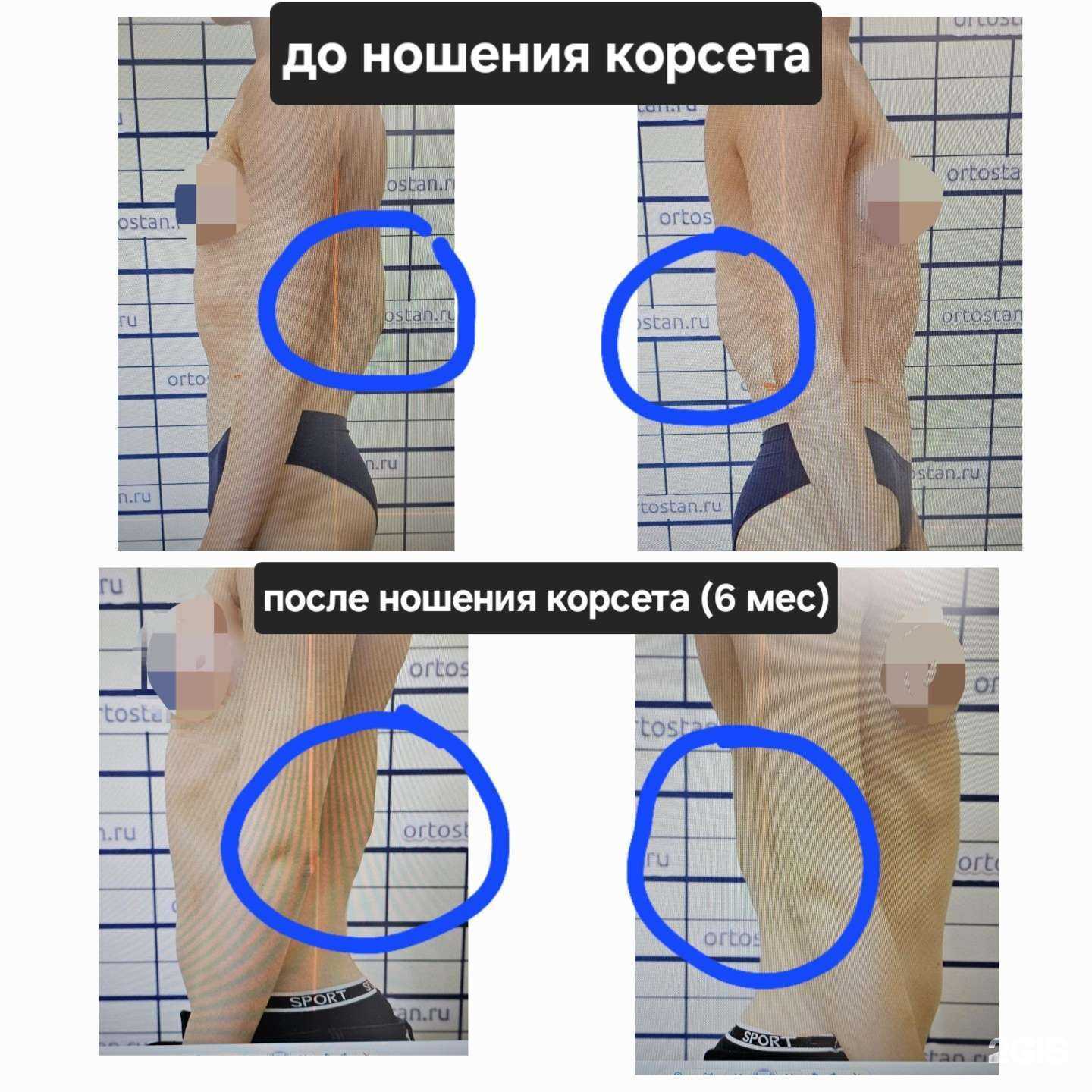 Отзывы на компанию Ортостан в г. Уфа c фото