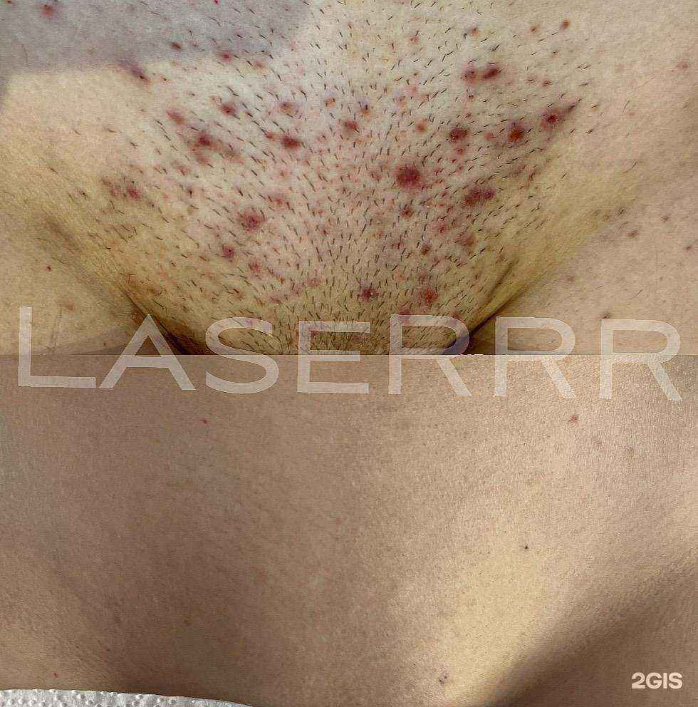 Отзывы на компанию Laserrr в г. Новосибирск c фото