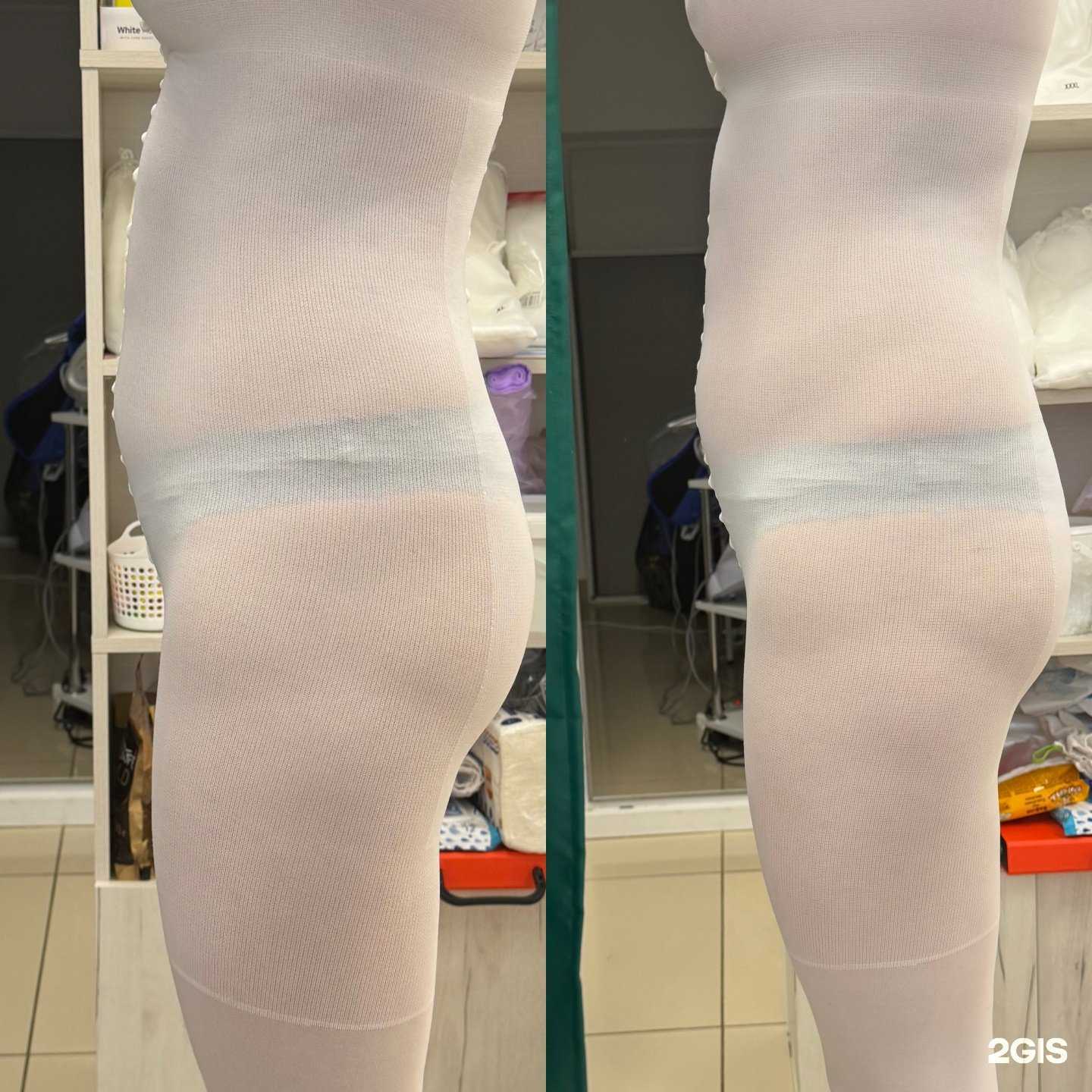 Отзывы на компанию Центр коррекции фигуры и эстетической косметологии в Самаре c фото