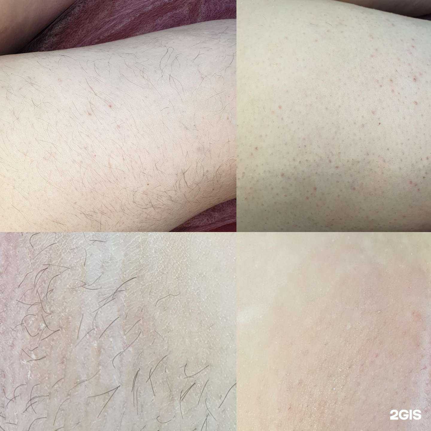 Отзывы на компанию Кабинет эпиляции в Омске c фото