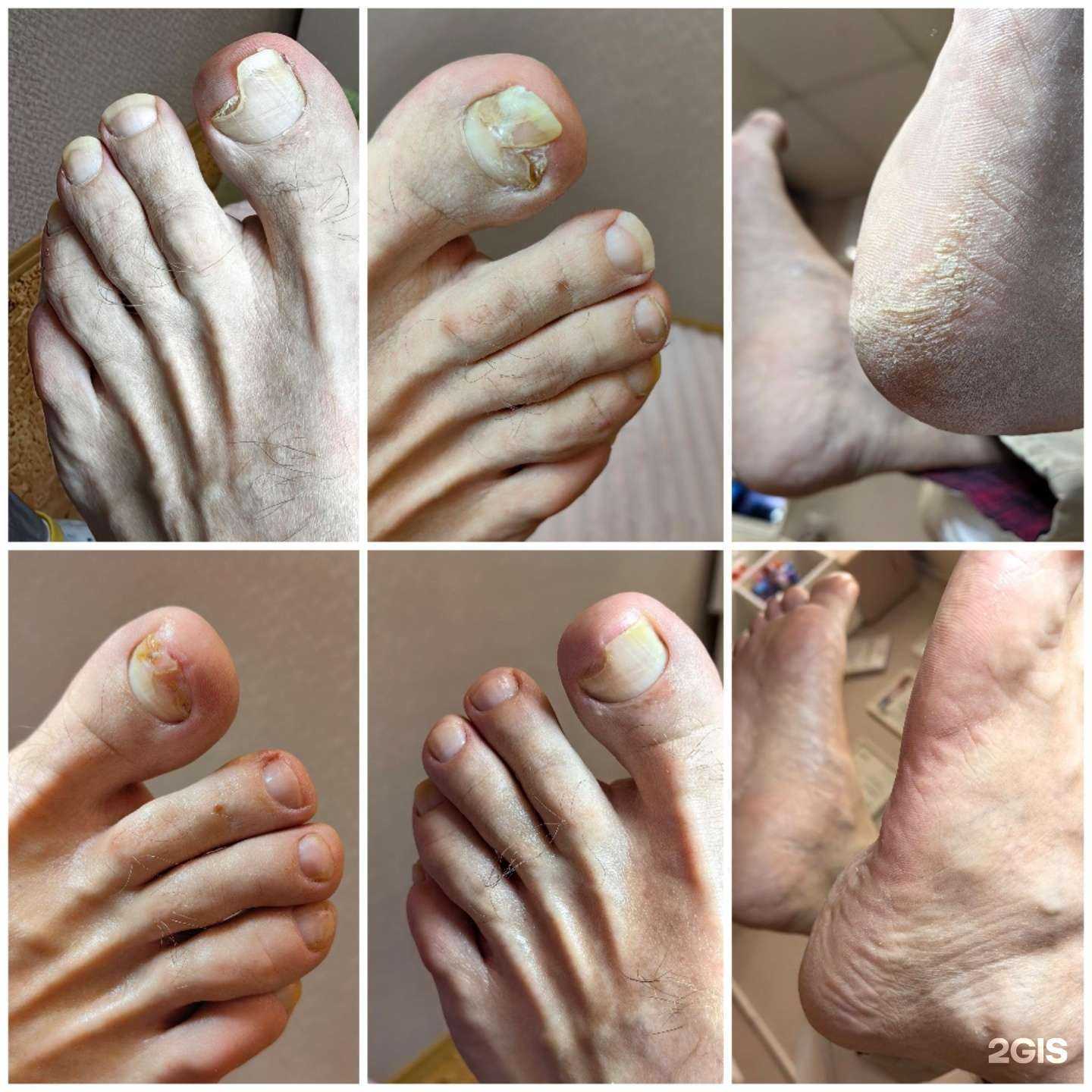 Отзывы на компанию PodoProfi в Новосибирске c фото