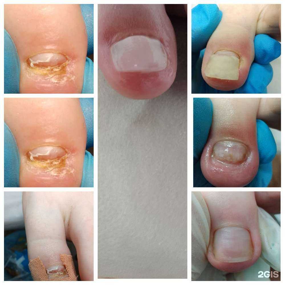 Отзывы на компанию Кабинет подолога-эстетиста в Иркутске c фото