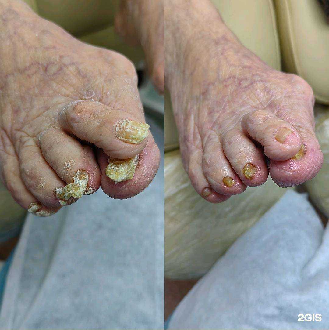 Отзывы на компанию Ваш педикюр в г. Астрахань c фото